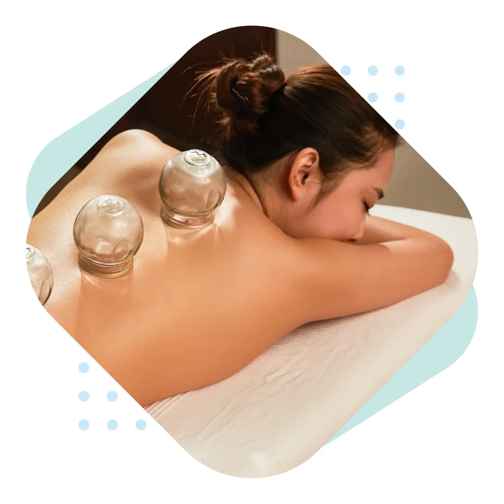 Cupping Therapy